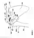 Fig. 05 - Modular, adjustable, prosthetic, hip/shoulder spacer