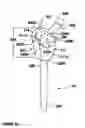 Fig. 08 - Modular, adjustable, prosthetic, hip/shoulder spacer