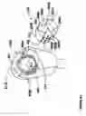 Fig. 15 - Modular, adjustable, prosthetic, hip/shoulder spacer