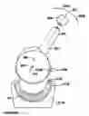 Fig. 16 - Modular, adjustable, prosthetic, hip/shoulder spacer