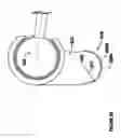 Fig. 23 - Modular, adjustable, prosthetic, hip/shoulder spacer