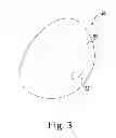 Fig. 04 - Method for performing an orthopaedic procedure