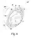 Fig. 05 - Method for performing an orthopaedic procedure