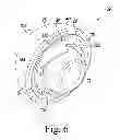 Fig. 07 - Method for performing an orthopaedic procedure