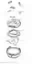 Fig. 12 - SURGICAL INSTRUMENT HEAD AND ASSEMBLY INCLUDING TAB SEPARATION MEMBER