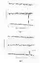 Fig. 04 - Device for detecting thickness of sheet-type medium and method thereof