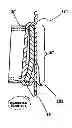Fig. 01 - Expandable Belt Loop