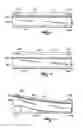Fig. 08 - Therapeutic mattress assembly