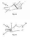 Fig. 05 - SHOE ADAPTED TO THE SHAPE OF THE FOOT