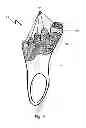 Fig. 09 - SHOE ADAPTED TO THE SHAPE OF THE FOOT