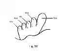 Fig. 10 - SHOE ADAPTED TO THE SHAPE OF THE FOOT