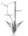 Fig. 11 - SHOE ADAPTED TO THE SHAPE OF THE FOOT
