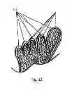 Fig. 12 - SHOE ADAPTED TO THE SHAPE OF THE FOOT