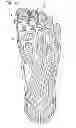 Fig. 14 - SHOE ADAPTED TO THE SHAPE OF THE FOOT