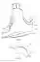Fig. 02 - Orthopedic walking boot with heel cushion