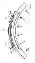 Fig. 06 - FBG strain sensor for curved surfaces