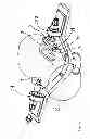Fig. 02 - SURGICAL FIXTURE DEVICE HAVING A RAPIDLY EXCHANGEABLE RETAINING PLATE FOR THE PRESSURE ELEMENTS