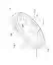 Fig. 09 - Relief valve