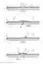 Fig. 02 - Methods of joining metallic protective layers