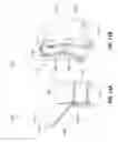 Fig. 07 - CASE COMPRISING A HANDLE