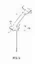 Fig. 05 - Chute turning restriction mechanism