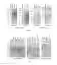 Fig. 02 - Native protein electrophoresis and methods of use