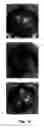 Fig. 17 - IN VITRO POINT-OF-CARE SENSOR AND METHOD OF USE