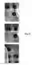 Fig. 30 - IN VITRO POINT-OF-CARE SENSOR AND METHOD OF USE