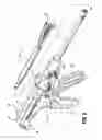 Fig. 06 - Surgical instrument with replaceable loading unit