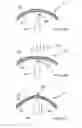 Fig. 07 - Wing slot seal