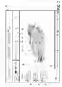 Fig. 03 - ANATOMICAL TAGGING OF FINDINGS IN IMAGE DATA OF SERIAL STUDIES