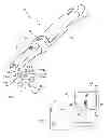 Fig. 01 - Dental camera for detecting caries