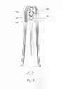 Fig. 03 - Dental camera for detecting caries