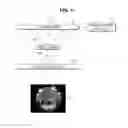 Fig. 07 - Camera assembly having a wide viewing angle and image acquisition method using the same