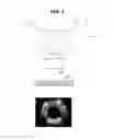 Fig. 08 - Camera assembly having a wide viewing angle and image acquisition method using the same