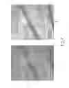 Fig. 08 - ASSESSMENT OF MICROVASCULAR CIRCULATION