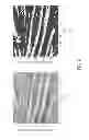 Fig. 10 - ASSESSMENT OF MICROVASCULAR CIRCULATION