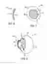Fig. 07 - Wavefront generation for ophthalmic applications