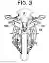 Fig. 04 - Vehicle headlight and projection lens