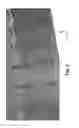 Fig. 08 - Tilted detector array for medical imaging systems including computed tomography