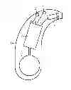 Fig. 01 - Method and device for reducing acoustic feedback
