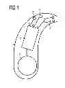 Fig. 02 - Method and device for reducing acoustic feedback