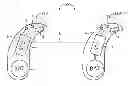 Fig. 01 - Method of controlling an effect strength of a binaural directional microphone, and hearing aid system