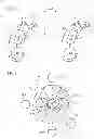 Fig. 02 - Method of controlling an effect strength of a binaural directional microphone, and hearing aid system