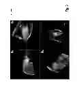 Fig. 04 - Methods and systems for automatically determining magnetic field inversion time of a tissue species