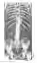 Fig. 01 - Positioning anatomical landmarks in volume data sets