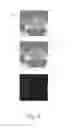 Fig. 06 - Shape-based image segmentation