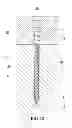 Fig. 11 - Screw