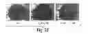 Fig. 64 - Nanoparticle and polymer formulations for thyroid hormone analogs, antagonists, and formulations thereof