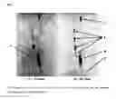 Fig. 08 - Compounds for binding to the platelet specific glycoprotein IIB/IIIA and their use for imaging of thrombi